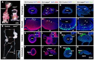 TALPID3/KIAA0586 Regulates Multiple Aspects of Neuromuscular Patterning During Gastrointestinal Development in Animal Models and Human